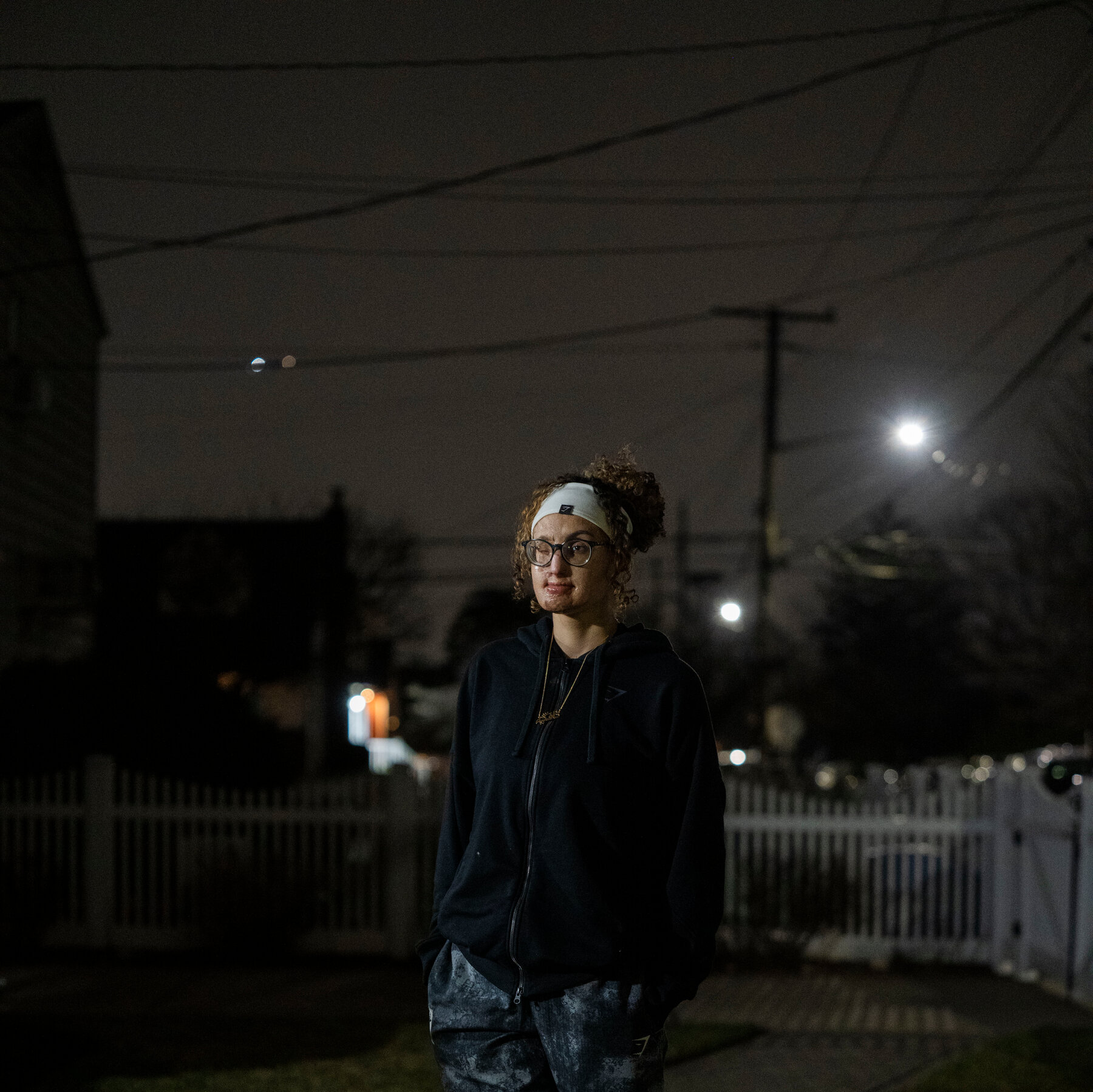 Searching for What Pretty Means After an Acid Attack