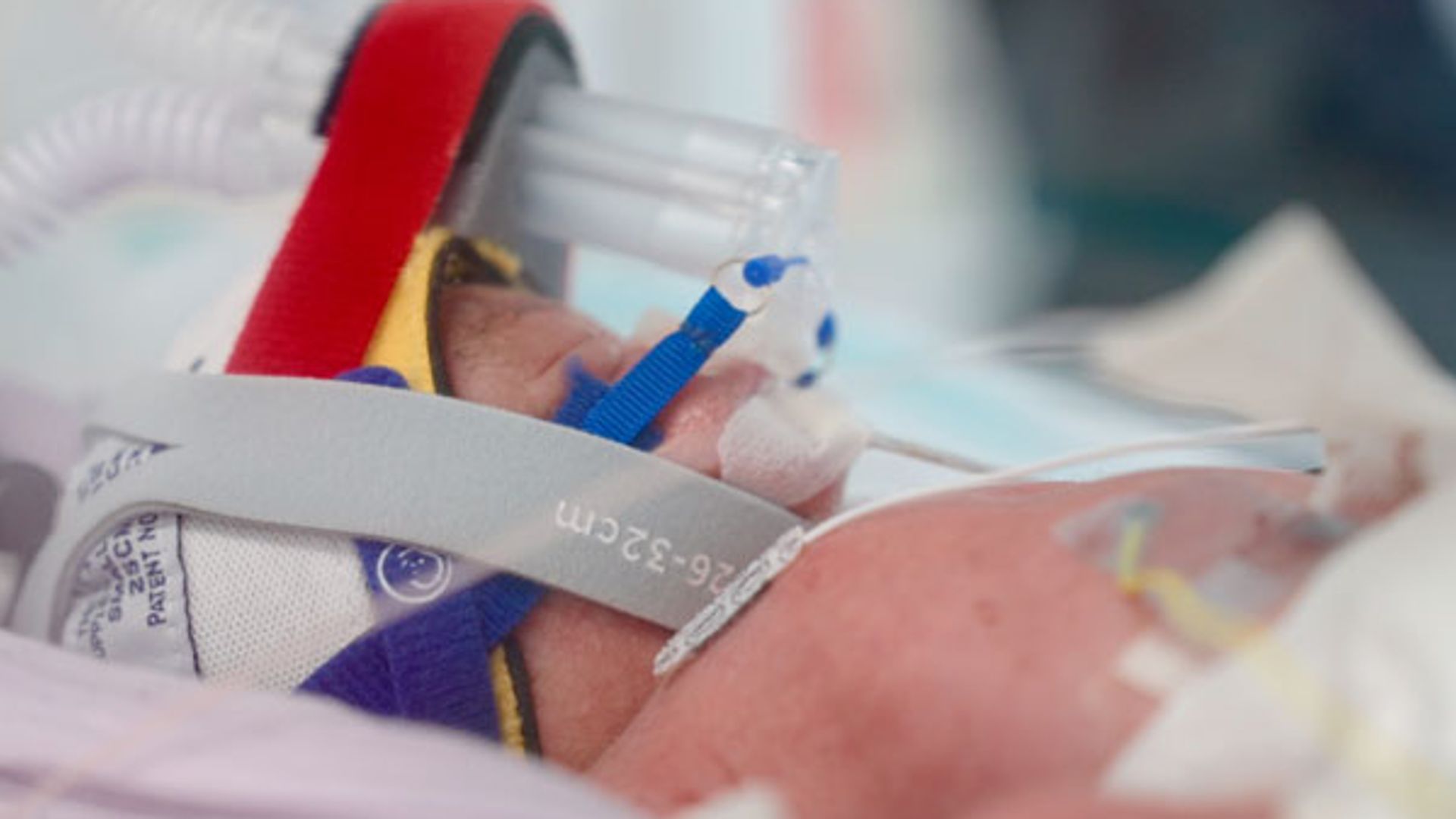 'One in 15 million chance' identical quadruplets born in Australia