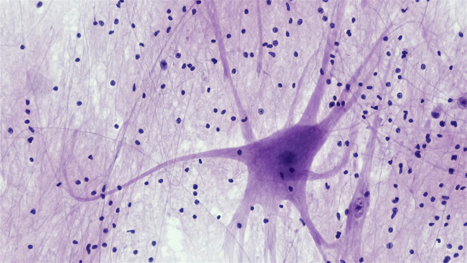 Nobelprijs Geneeskunde voor lichtschakelaar in hersencellen