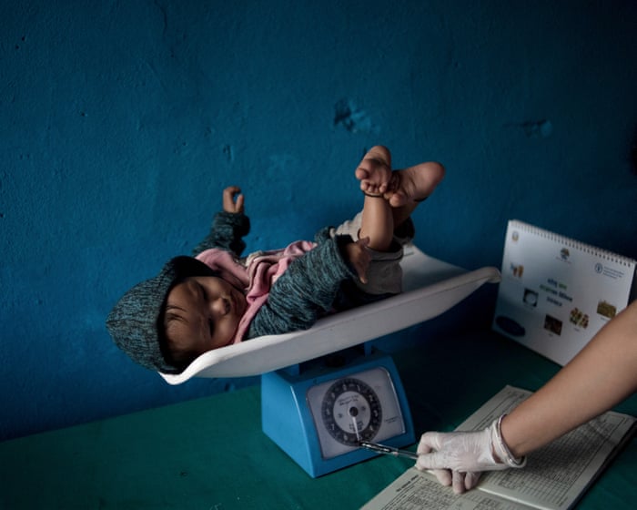 Child malnutrition in Nepal has reached ‘alarming’ levels since aid cuts, survey finds