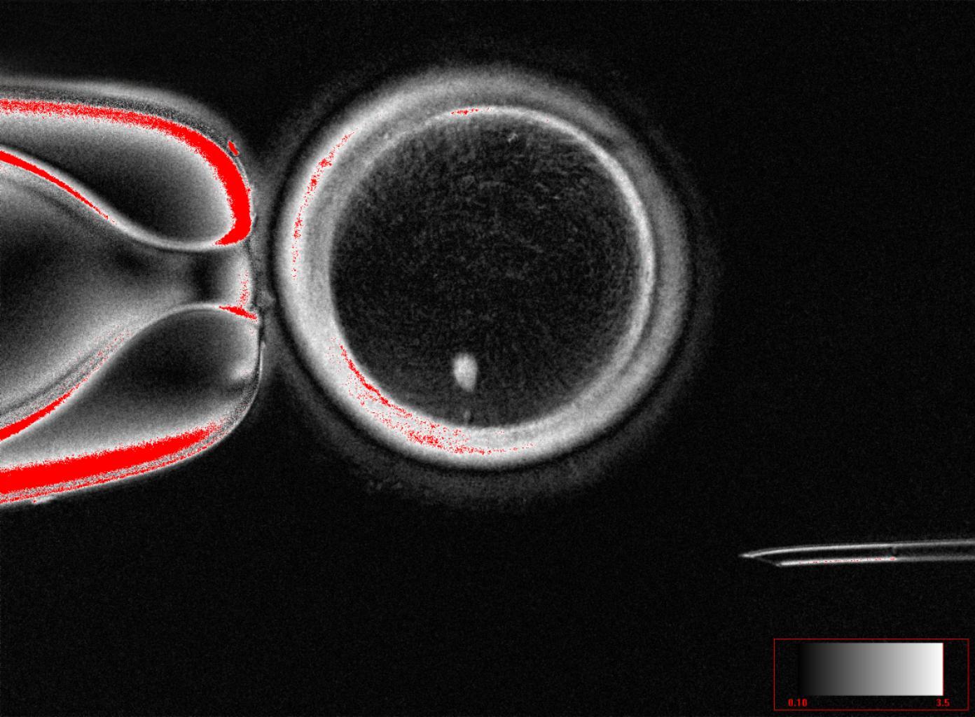 Scientists create human eggs in the lab, using skin cells