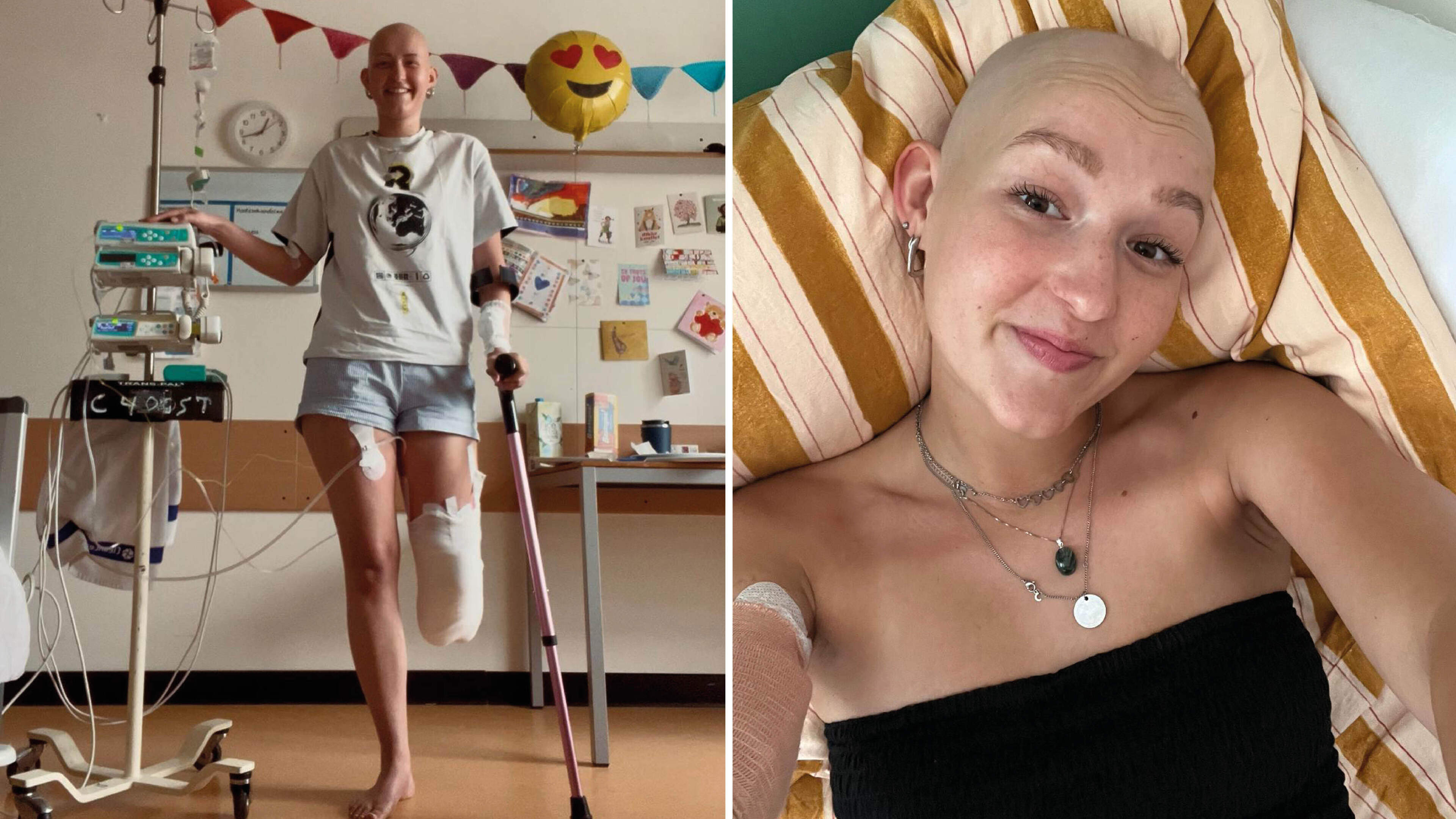 Sarah (21) heeft wekedelenkanker en moest haar onderbeen laten amputeren: ’Onderbuikgevoel zei direct dat het niet goed was’