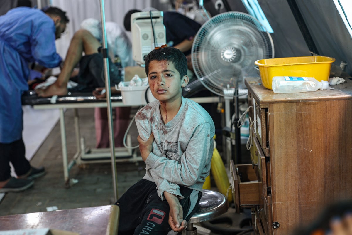 Bombed, starving and orphaned: The horrific plight of children arriving in Gaza’s hospitals alone