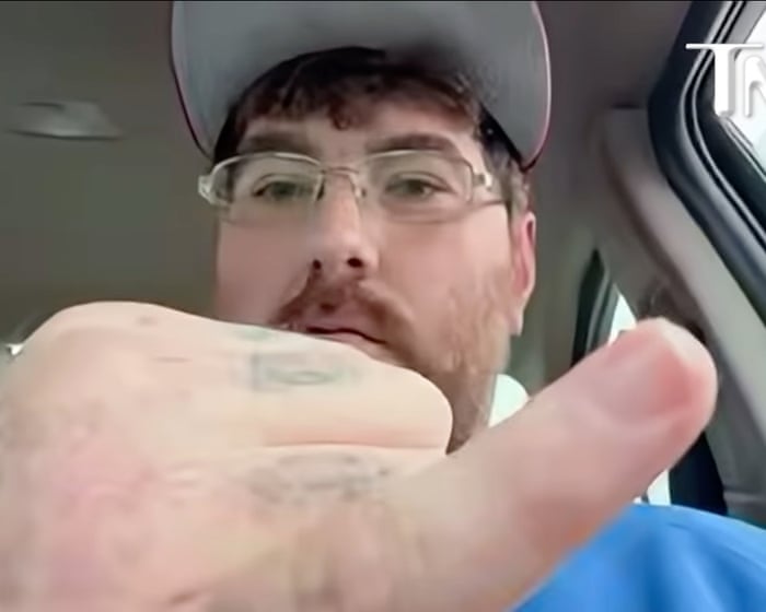 US man issues challenge to disprove his claim of having world’s smallest penis to raise micropenis awareness