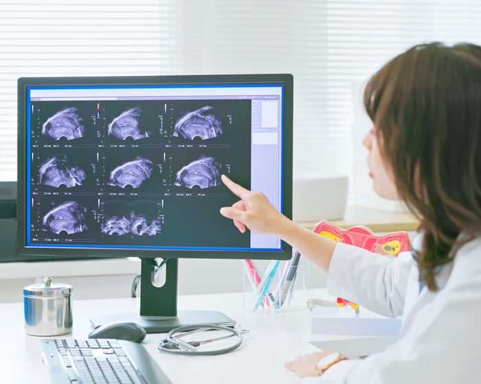 Trial of non-invasive endometriosis scan boosts hopes for quicker diagnosis