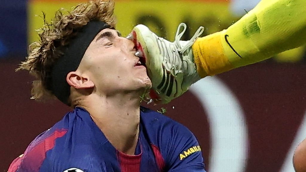 Tiental Barcelona strandt in Champions League na verhit duel met Atlético Madrid